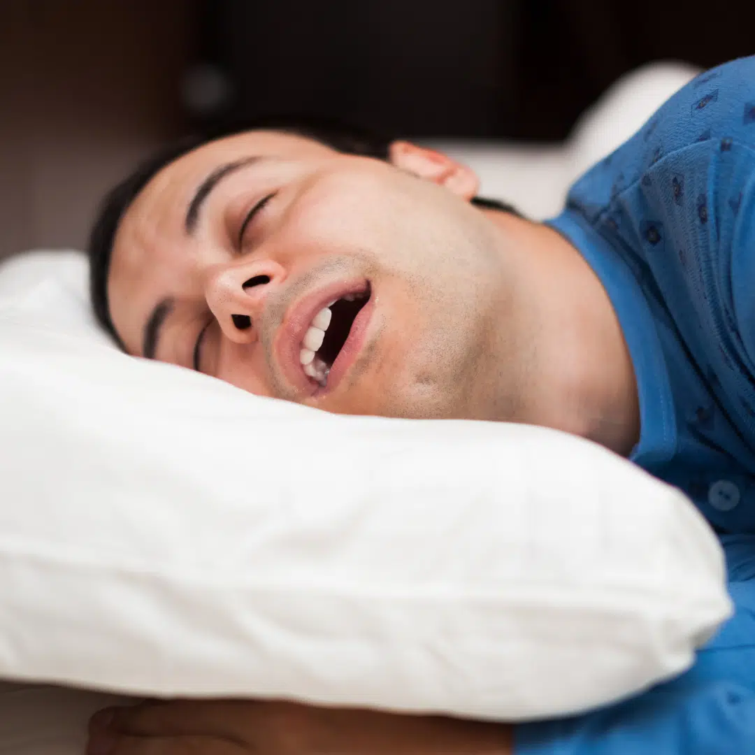 Fiatal férfi oldalt fekszik, nyitott szájjal alszik, horkol.